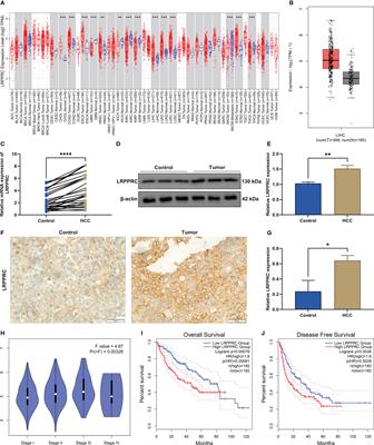 LRPPRC facilitates tumor progression and immune evasion through upregulation of m6A modification of PD-L1 mRNA in hepatocellular carcinoma